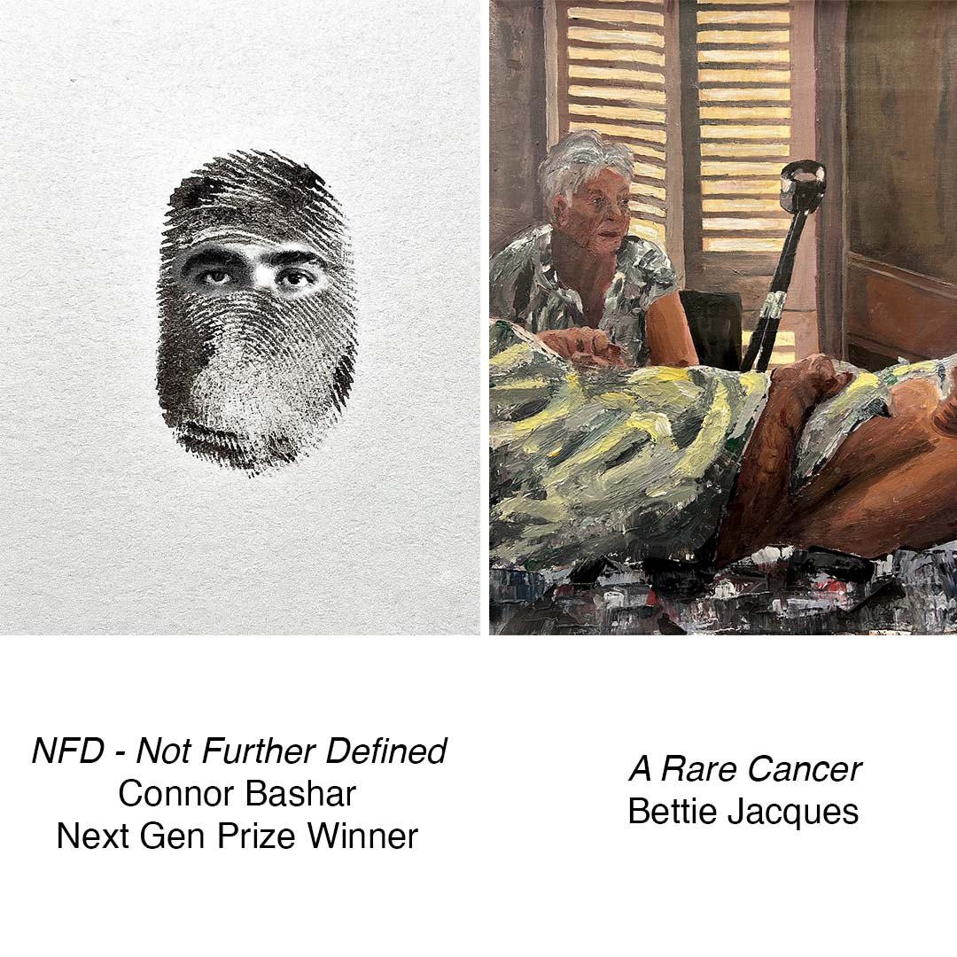 NFD and A Rare Cancer.jpg